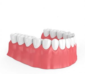 4 - Dentes em posição